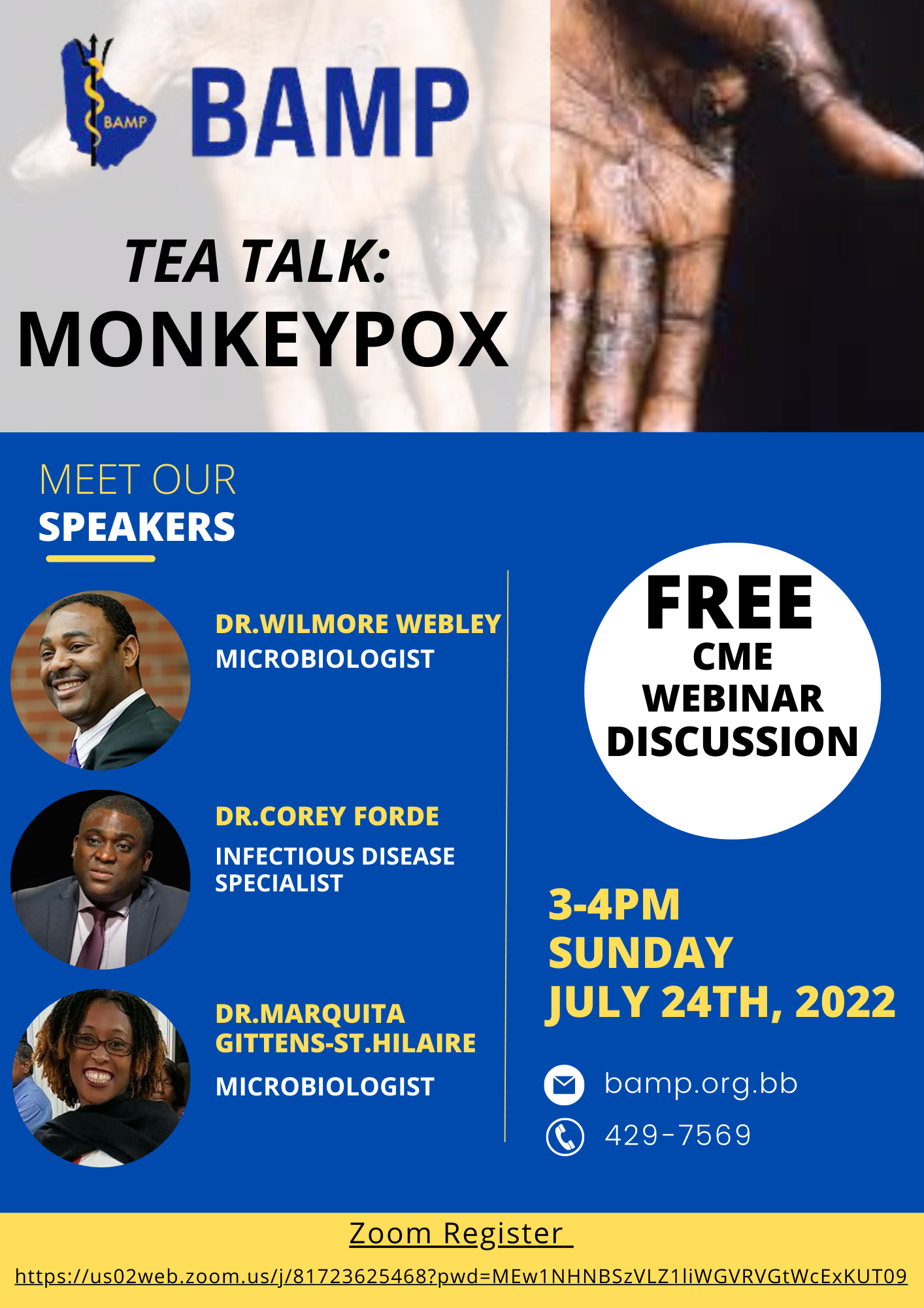 Tea Talk: Monkeypox